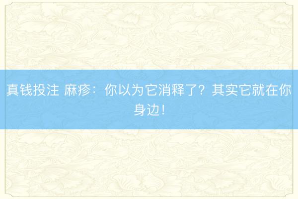 真钱投注 麻疹：你以为它消释了？其实它就在你身边！