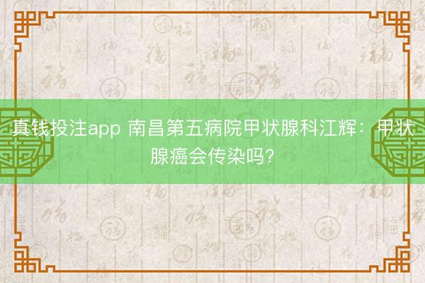 真钱投注app 南昌第五病院甲状腺科江辉:甲状腺癌会传染吗?